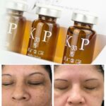 Пилинг K33P Mesosystem МССМ PEELING